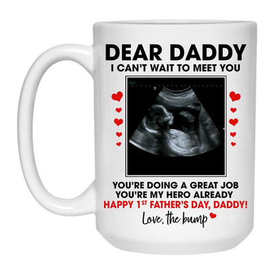 Dear Daddy, I can't wait to meet you, Happy 1st Father's Day, Customized Photo Coffee Mug, Personalized Gift, Funny Father's Day gift